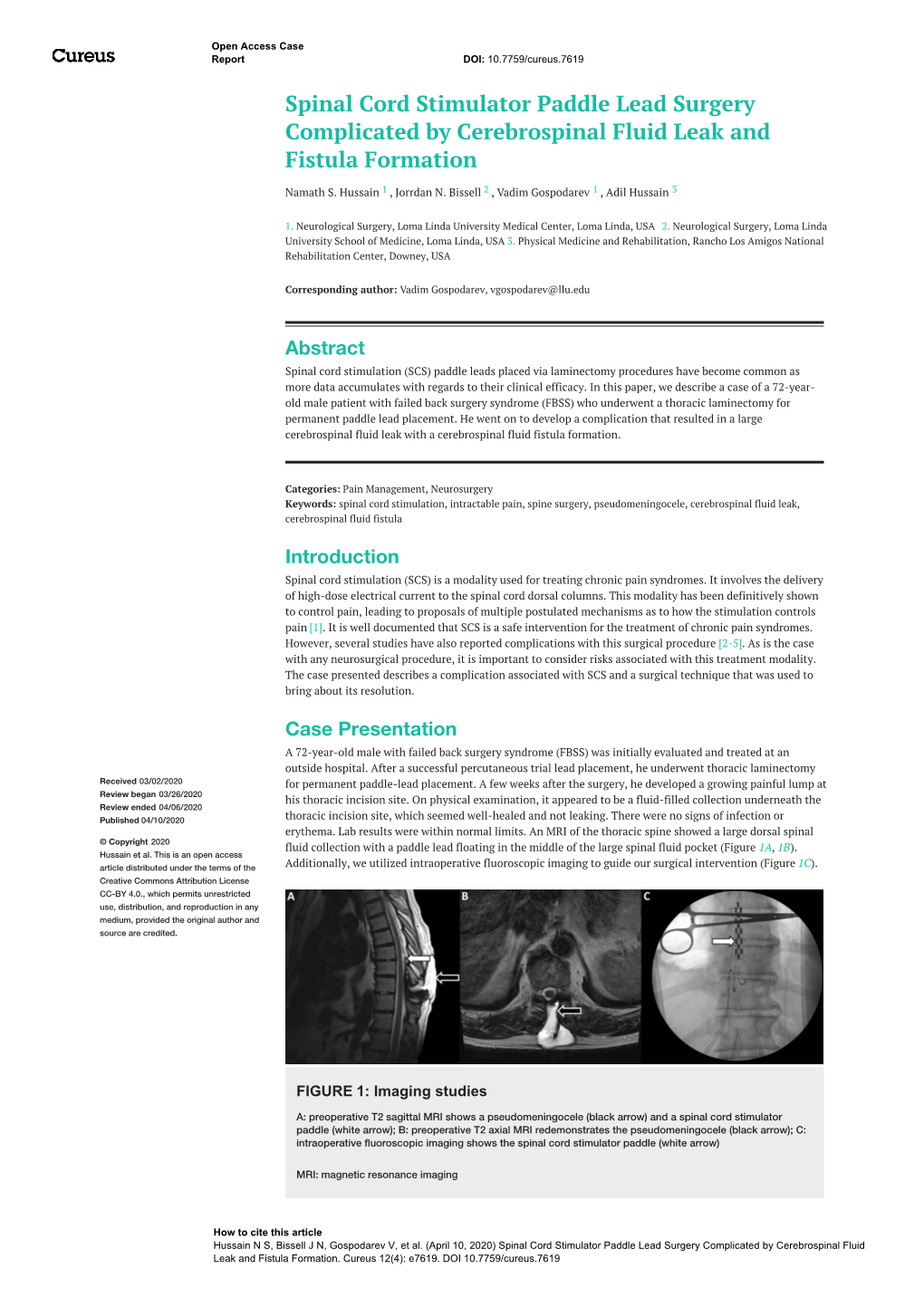 Spinal Cord Stimulator Paddle Lead Surgery Complicated by Cerebrospinal Fluid Leak and Fistula Formation