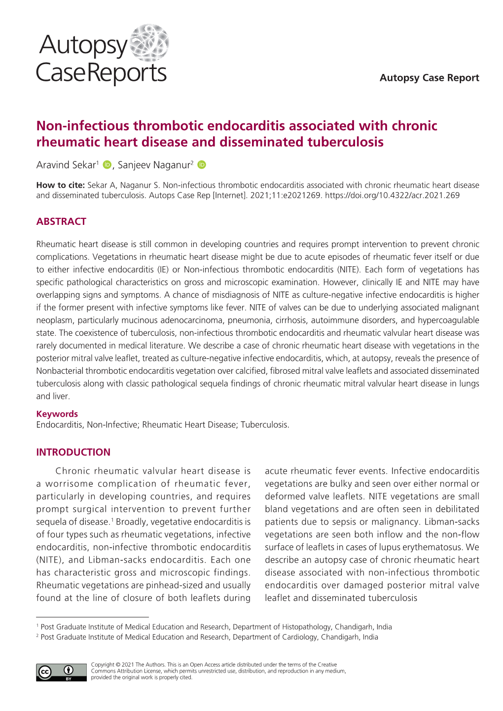 Non-Infectious Thrombotic Endocarditis Associated with Chronic Rheumatic Heart Disease and Disseminated Tuberculosis