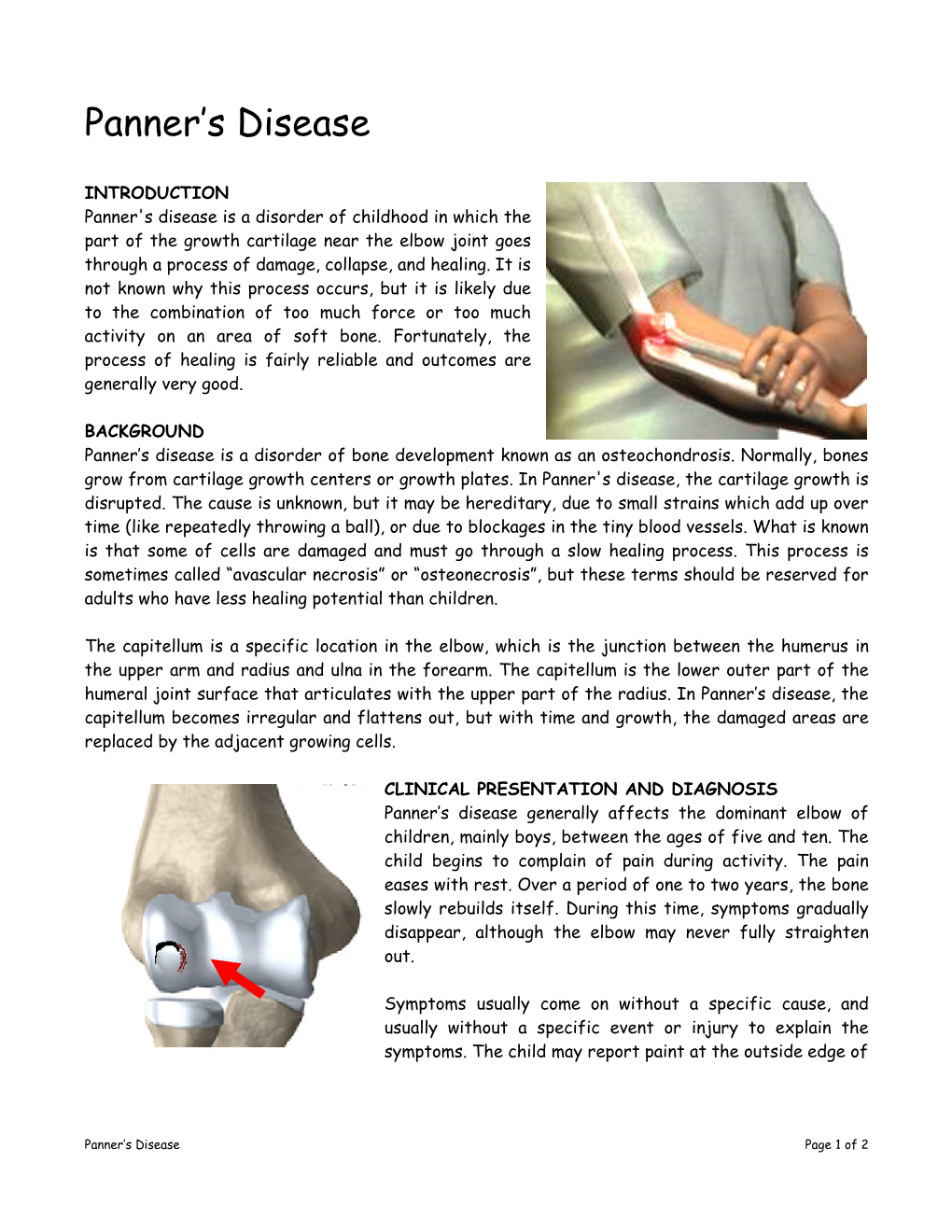 Panner's Disease Is a Disorder of Childhood in Which the Part of the Growth Cartilage Near the Elbow Joint Goes Through a Process of Damage, Collapse, and Healing