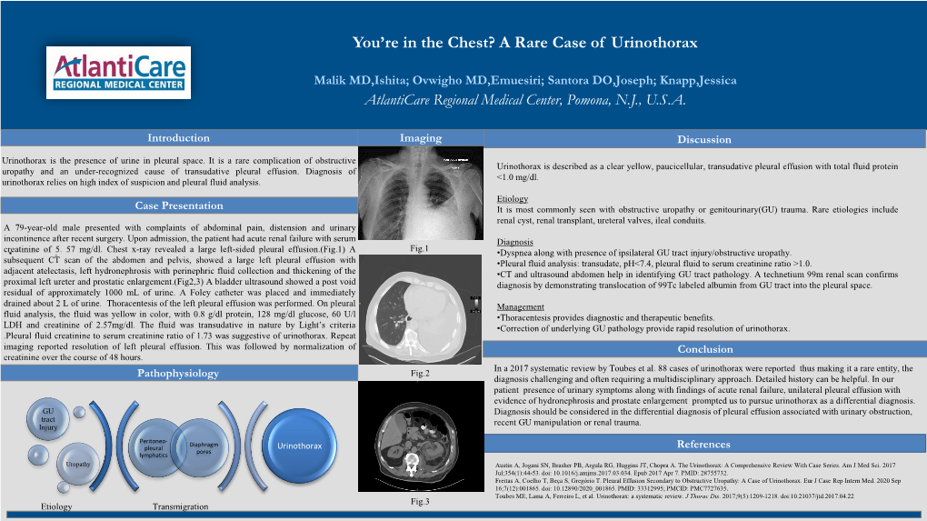 You're in the Chest? a Rare Case of Urinothorax