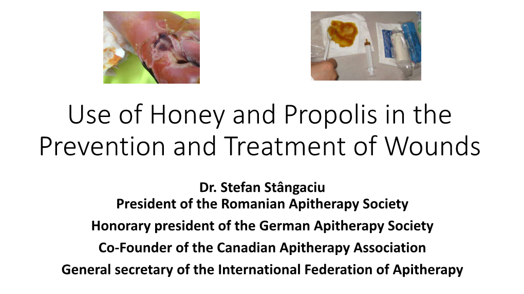 Use of Honey and Propolis in the Treatment of Wounds