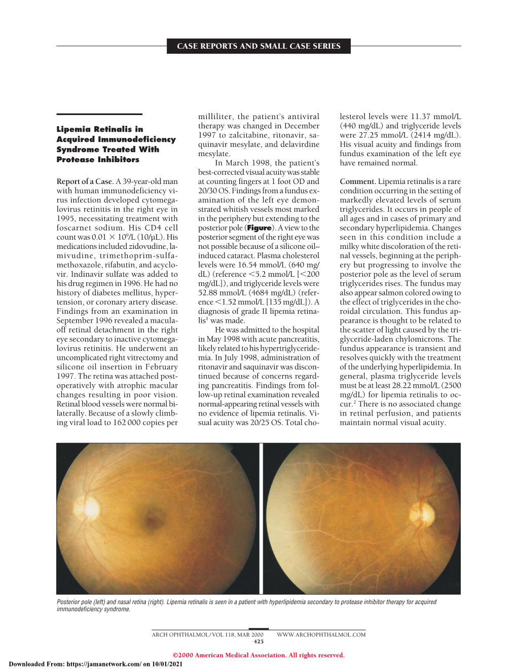 Retinal Toxic Effects Associated with Intravitreal Fomivirsen