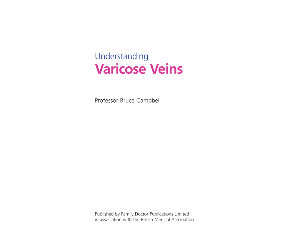 Varicose Veins