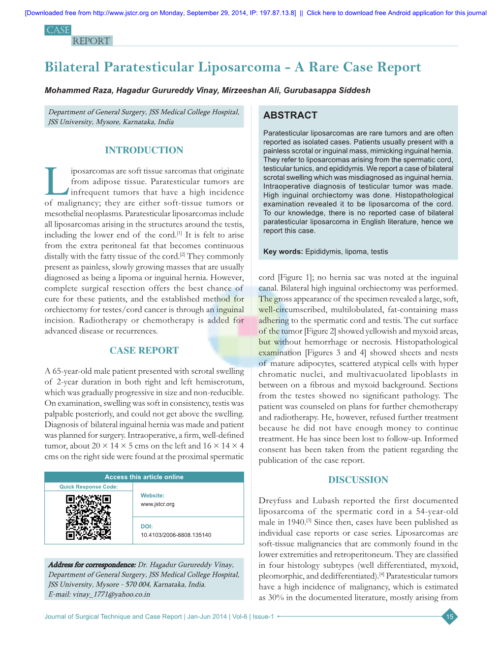 Bilateral Paratesticular Liposarcoma ‑ a Rare Case Report