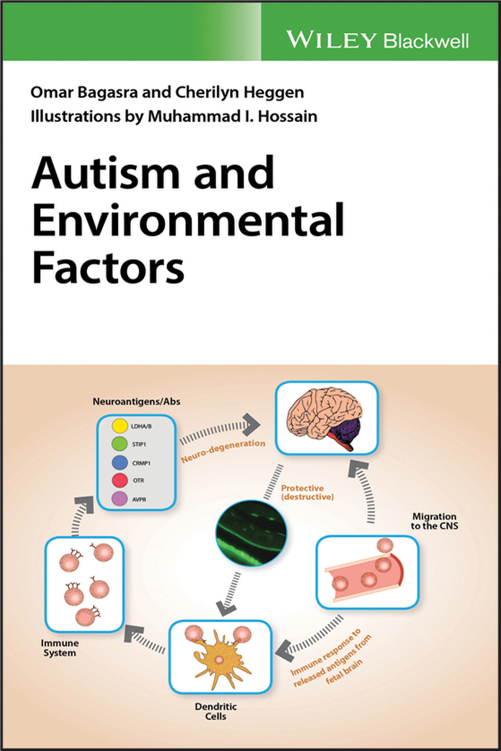 Autism and Environmental Factors