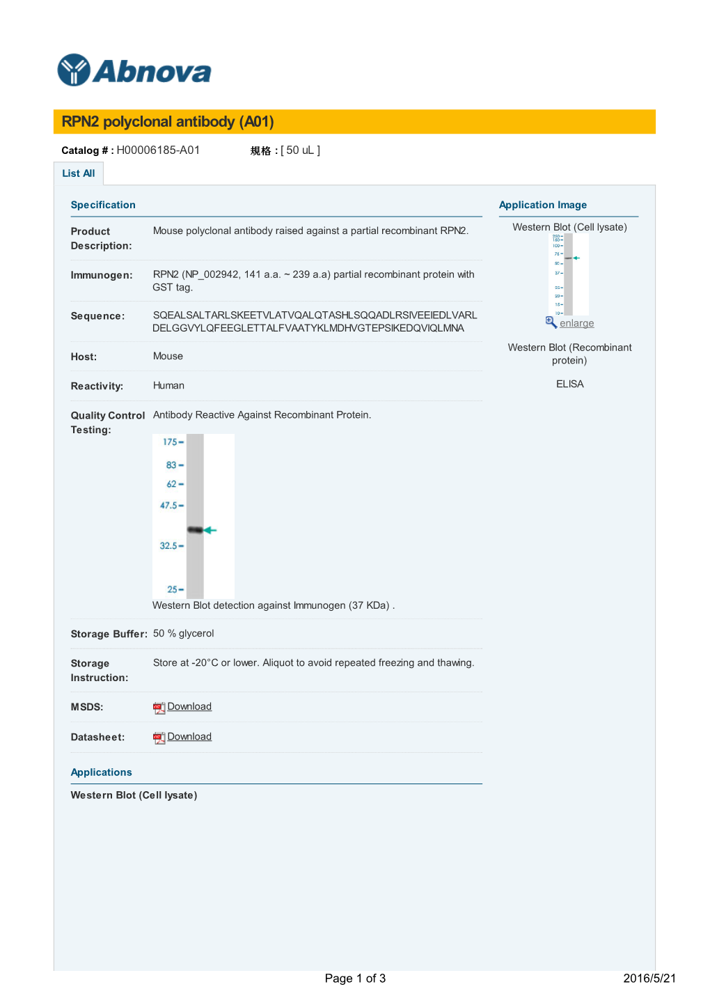 RPN2 Polyclonal Antibody (A01)