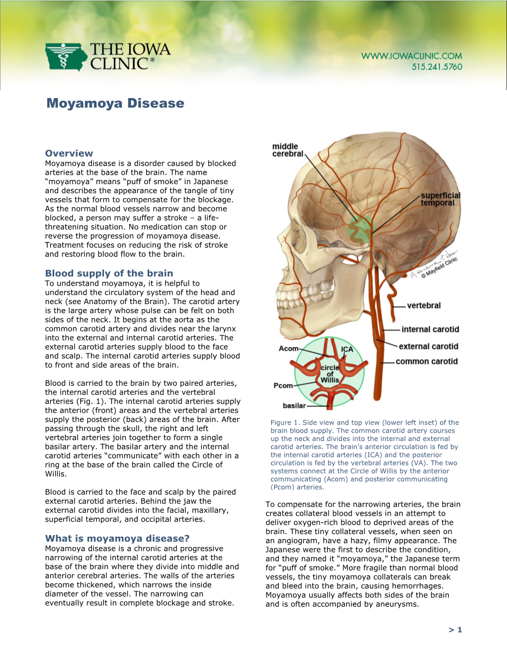 Moyamoya Disease.Pdf