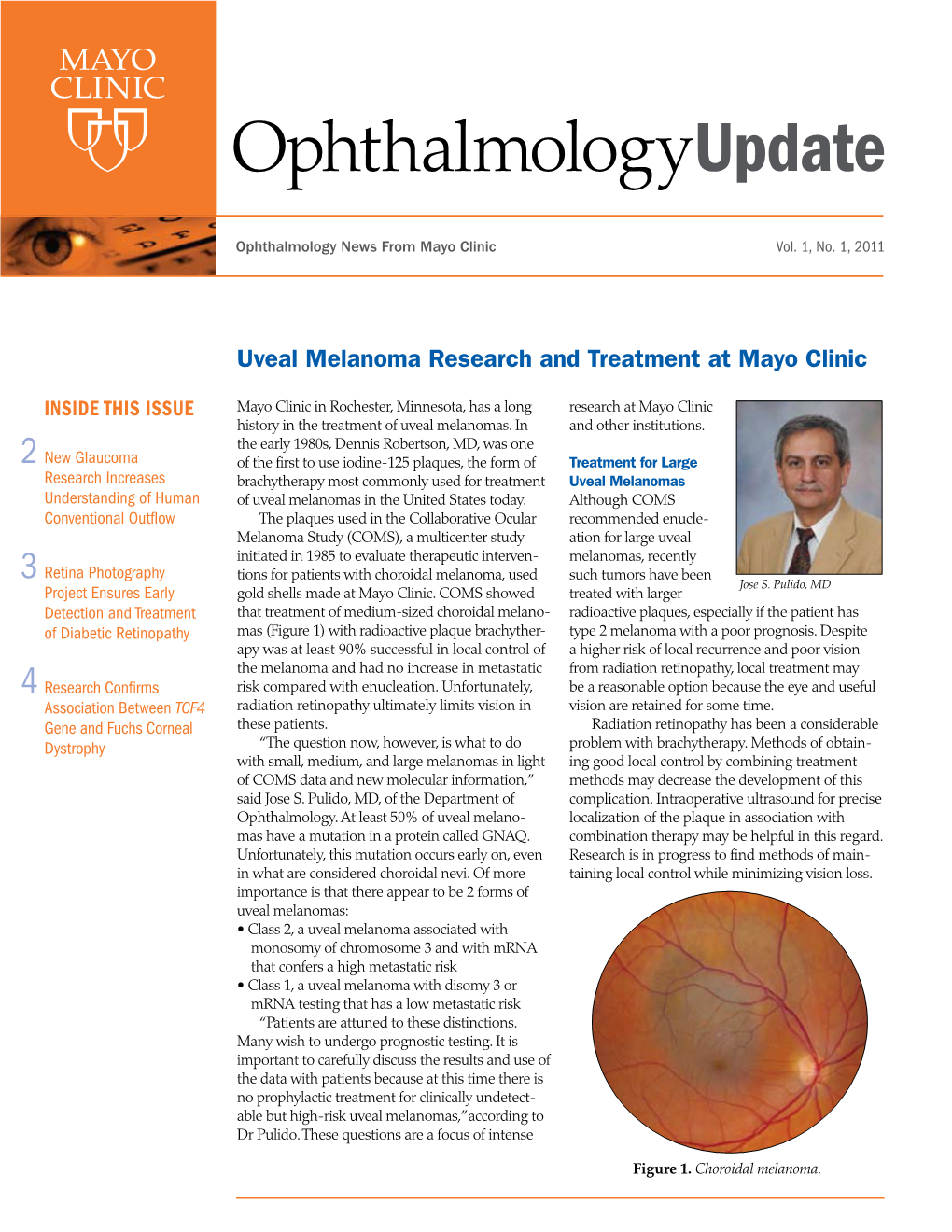 Uveal Melanoma Research and Treatment at Mayo Clinic