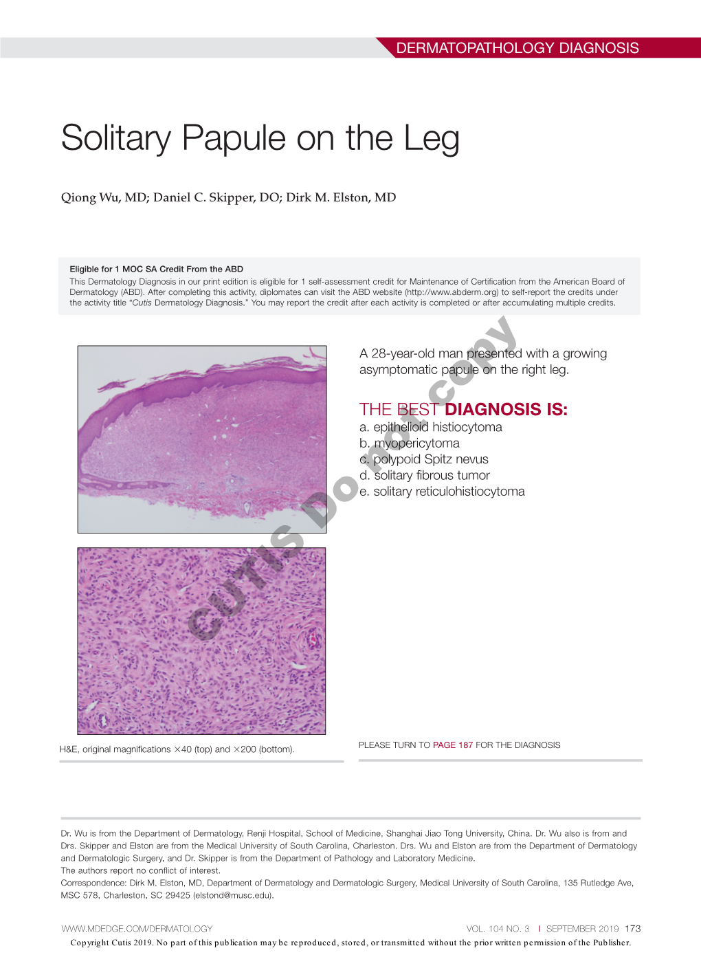 Solitary Papule on the Leg