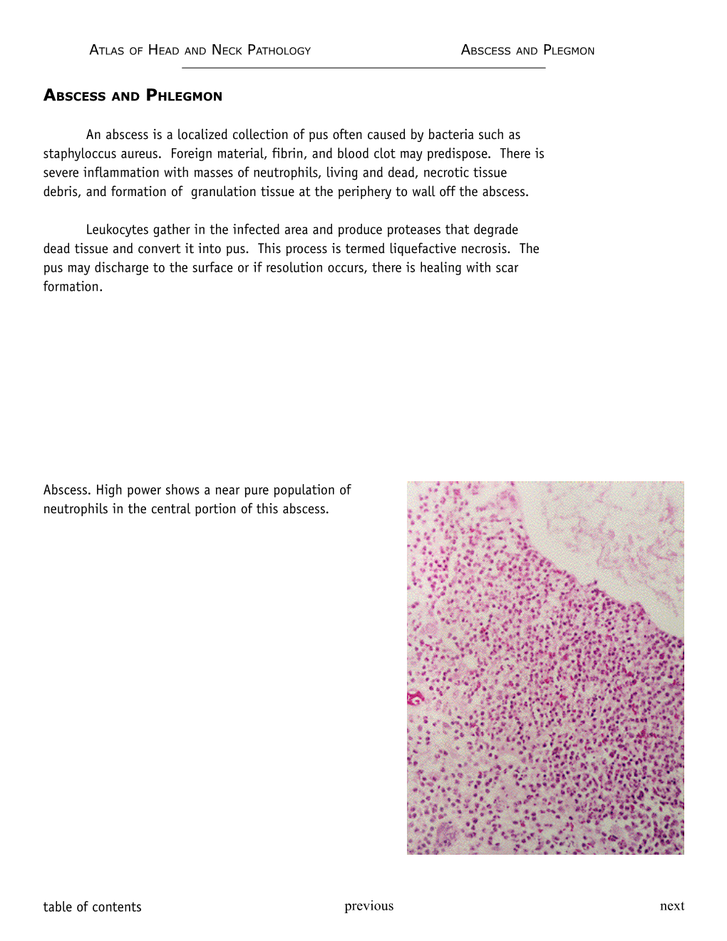 Abscess and Phlegmon