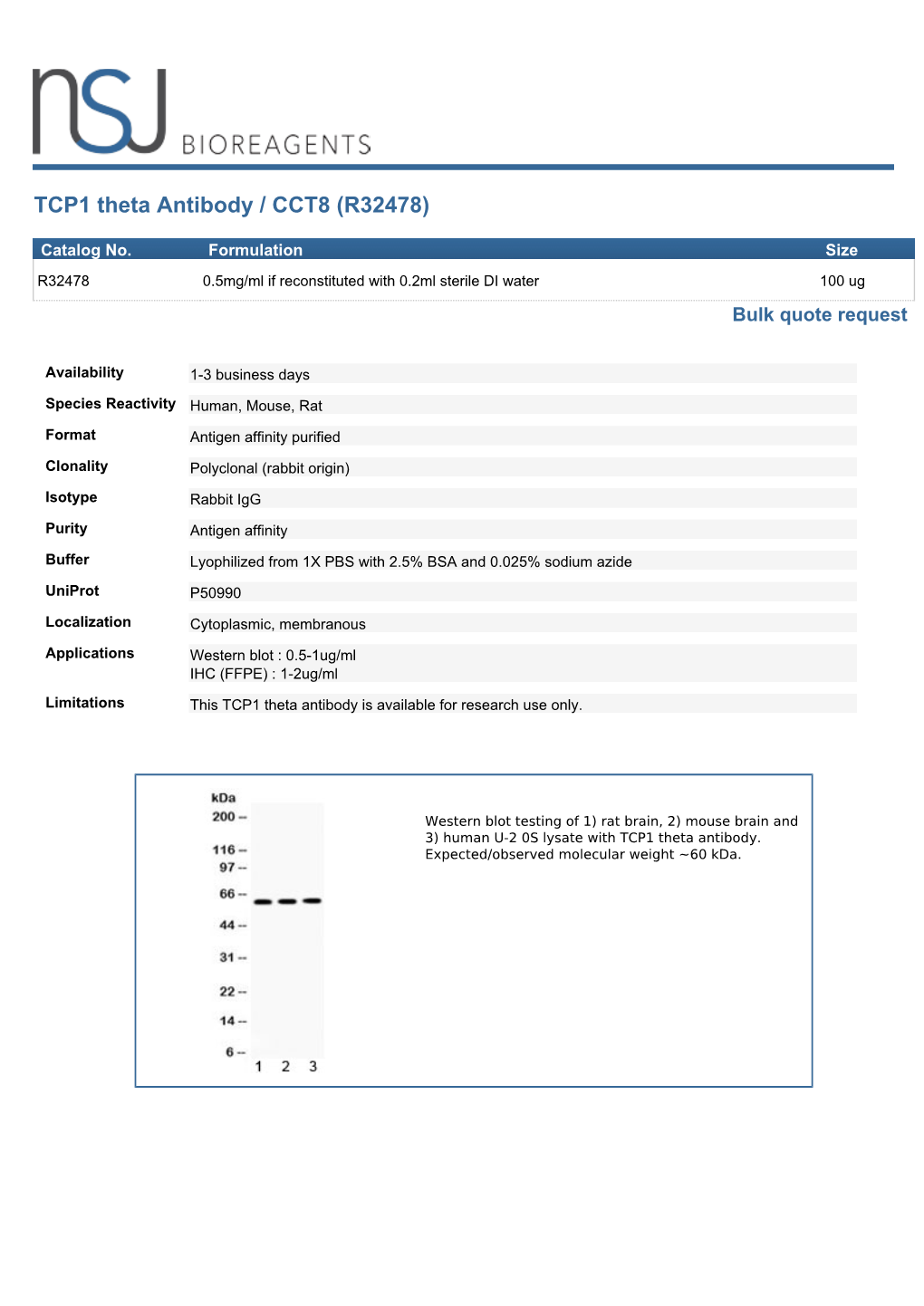 TCP1 Theta Antibody / CCT8 (R32478)