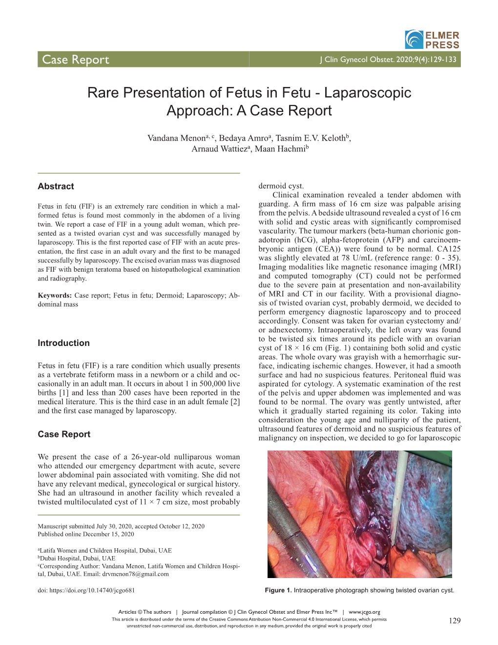 Rare Presentation of Fetus in Fetu - Laparoscopic Approach: a Case Report