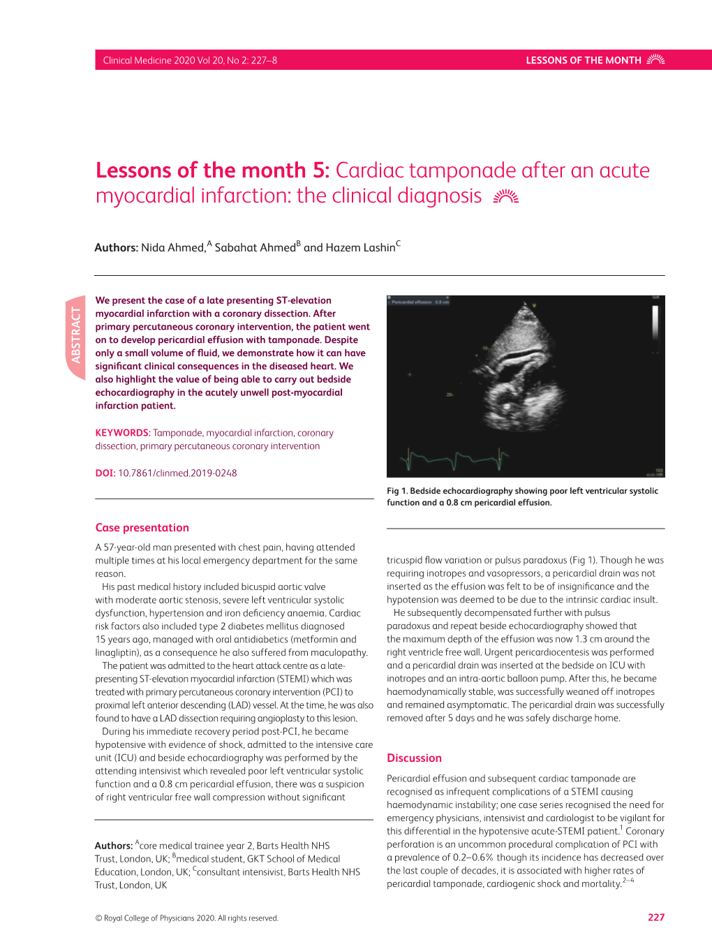 Cardiac Tamponade After an Acute Myocardial Infarction: the Clinical Diagnosis