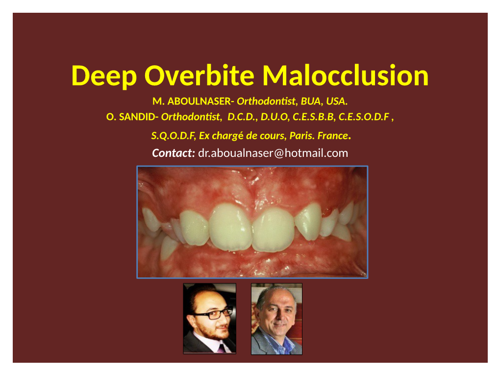 Deep Overbite Malocclusion M