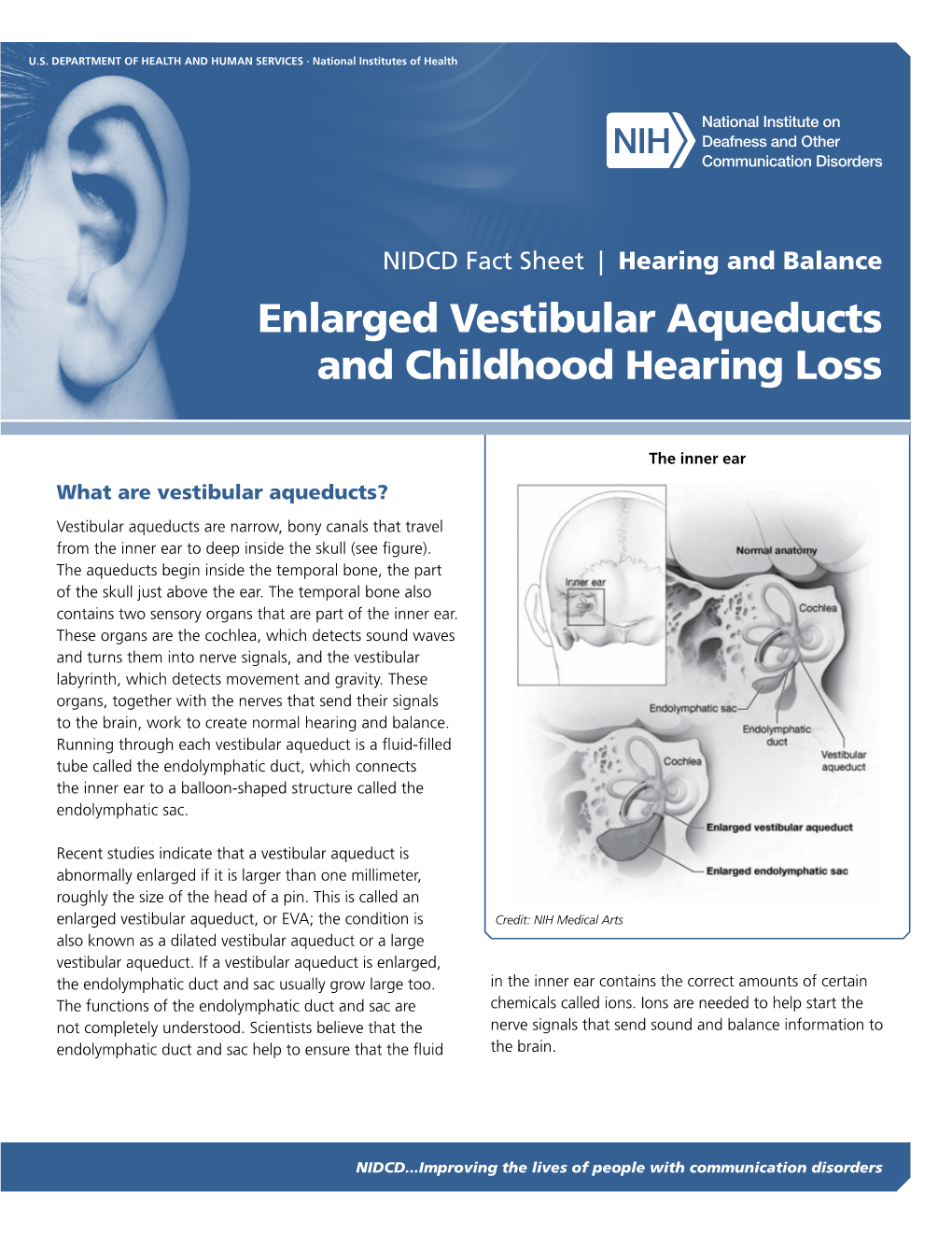 Enlarged Vestibular Aqueducts and Childhood Hearing Loss