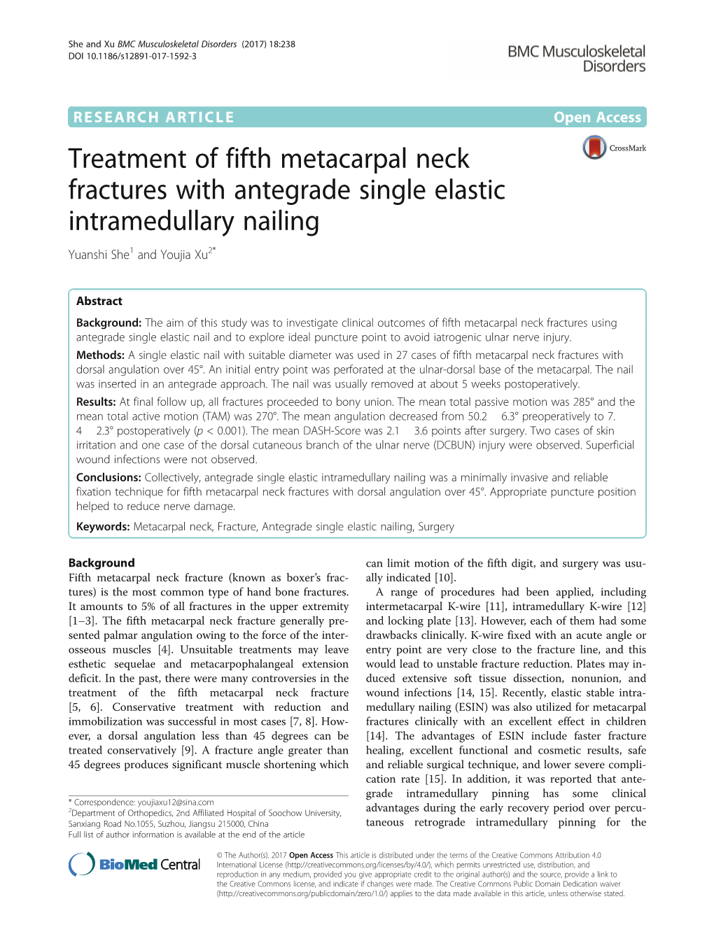 Treatment of Fifth Metacarpal Neck Fractures with Antegrade Single Elastic Intramedullary Nailing Yuanshi She1 and Youjia Xu2*