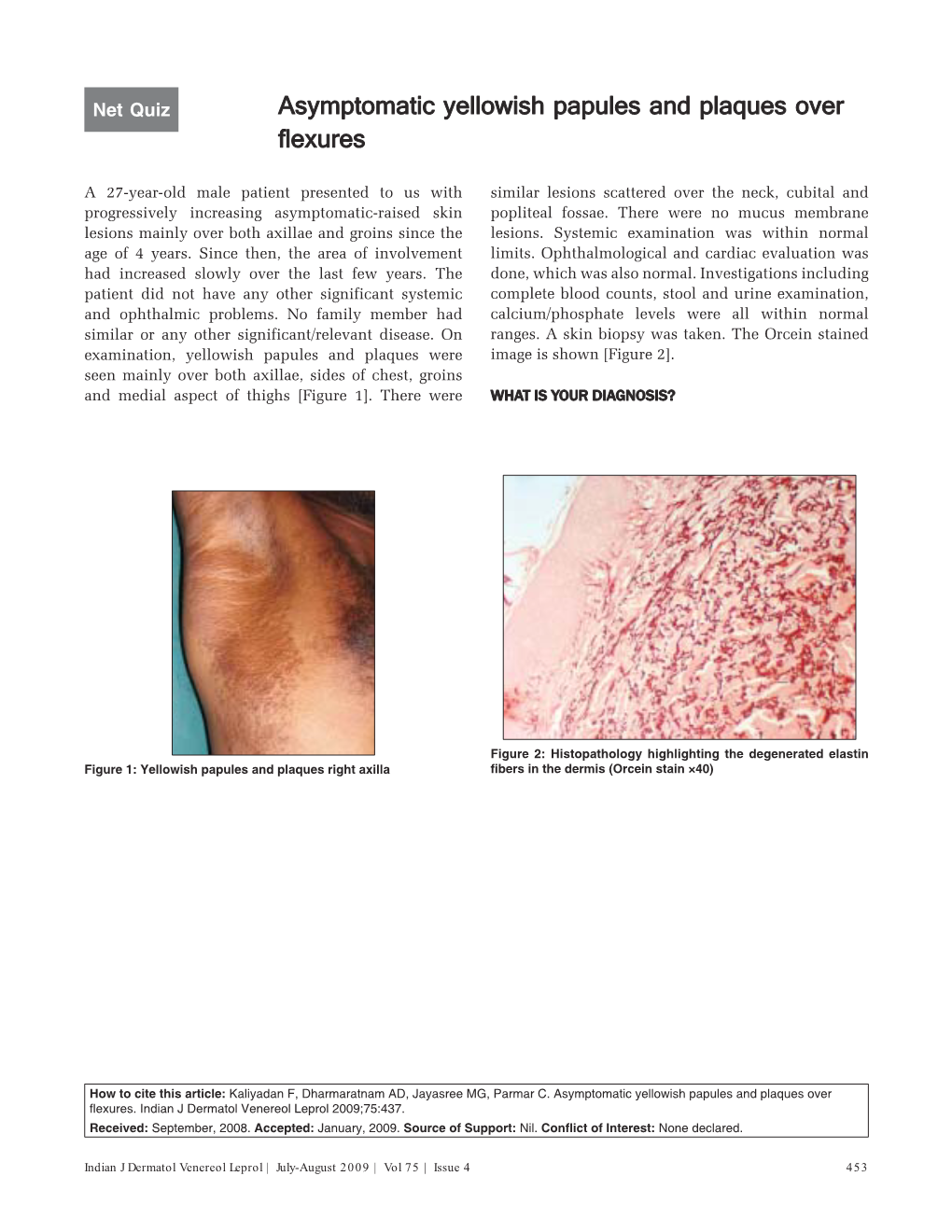 Asymptomatic Yellowish Papules and Plaques Over Flexures