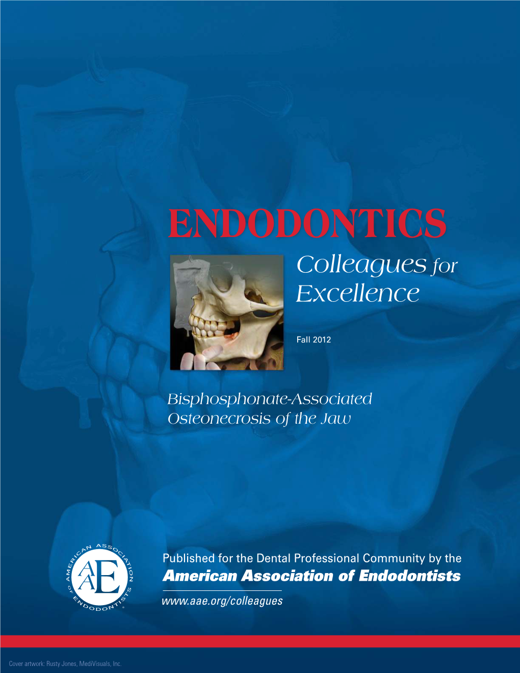 Bisphosphonate-Associated Osteonecrosis of the Jaw