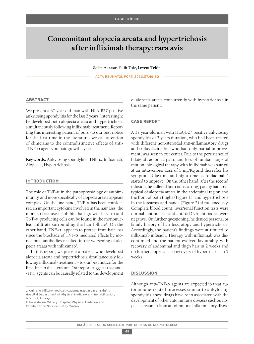 Concomitant Alopecia Areata and Hypertrichosis After Infliximab Therapy: Rara Avis