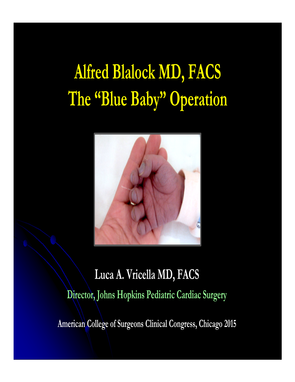 Alfred Blalock MD, FACS the “Blue Baby” Operation