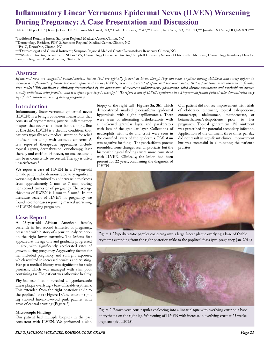 Inflammatory Linear Verrucous Epidermal Nevus (ILVEN) Worsening During Pregnancy: a Case Presentation and Discussion Felicia E