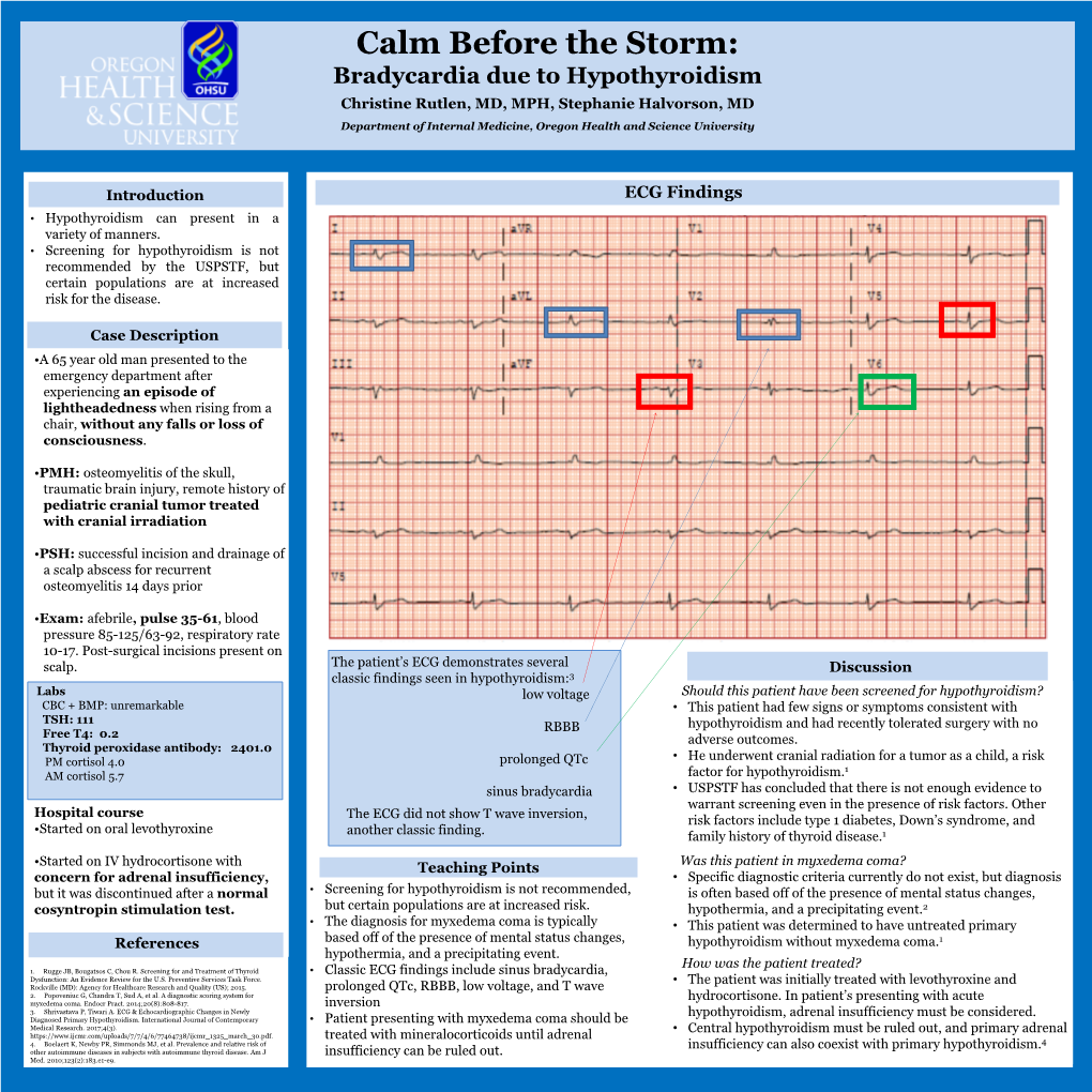 Calm Before the Storm: Bradycardia Due to Hypothyroidism