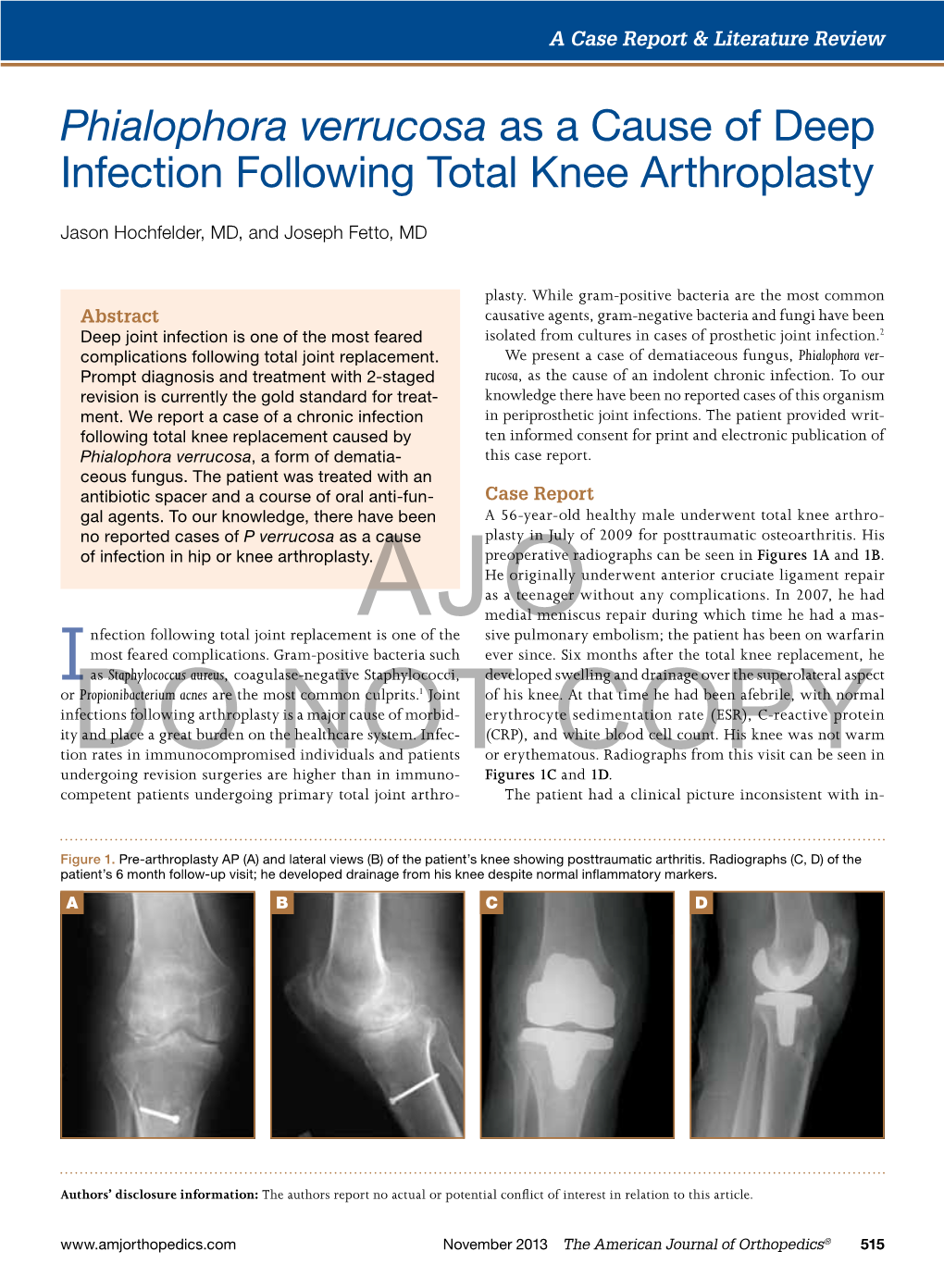 Phialophora Verrucosa As a Cause of Deep Infection Following Total Knee Arthroplasty