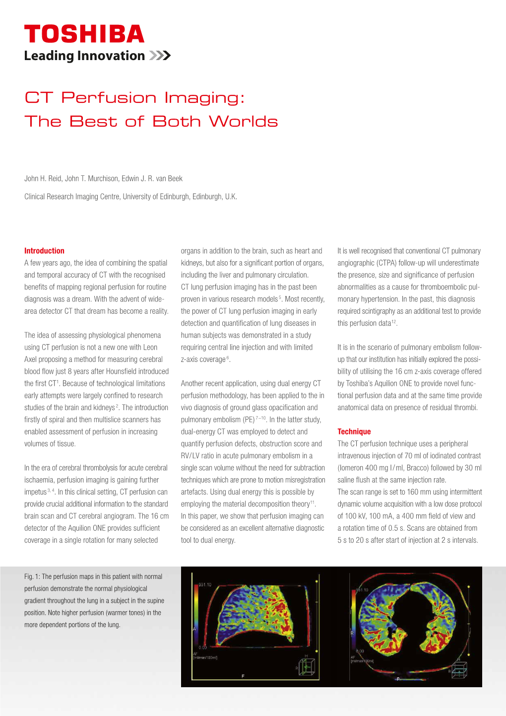 CT Perfusion Imaging: the Best of Both Worlds