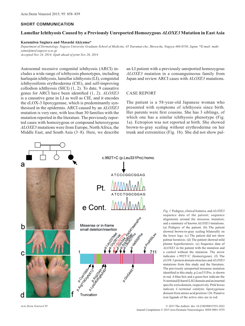 Lamellar Ichthyosis Caused by a Previously Unreported Homozygous ALOXE3 Mutation in East Asia