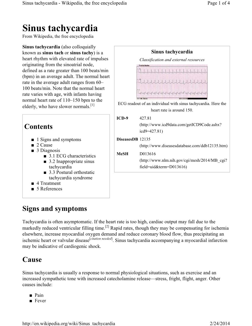 Sinus Tachycardia - Wikipedia, the Free Encyclopedia Page 1 of 4