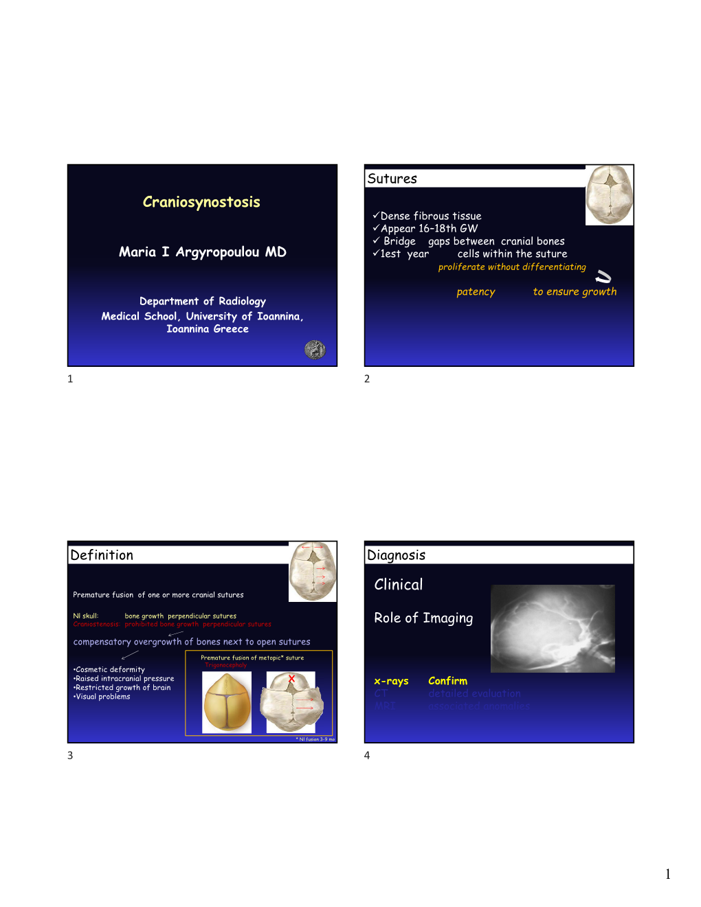 79037-Craniostenosis Dr. Argyropolou.Pdf