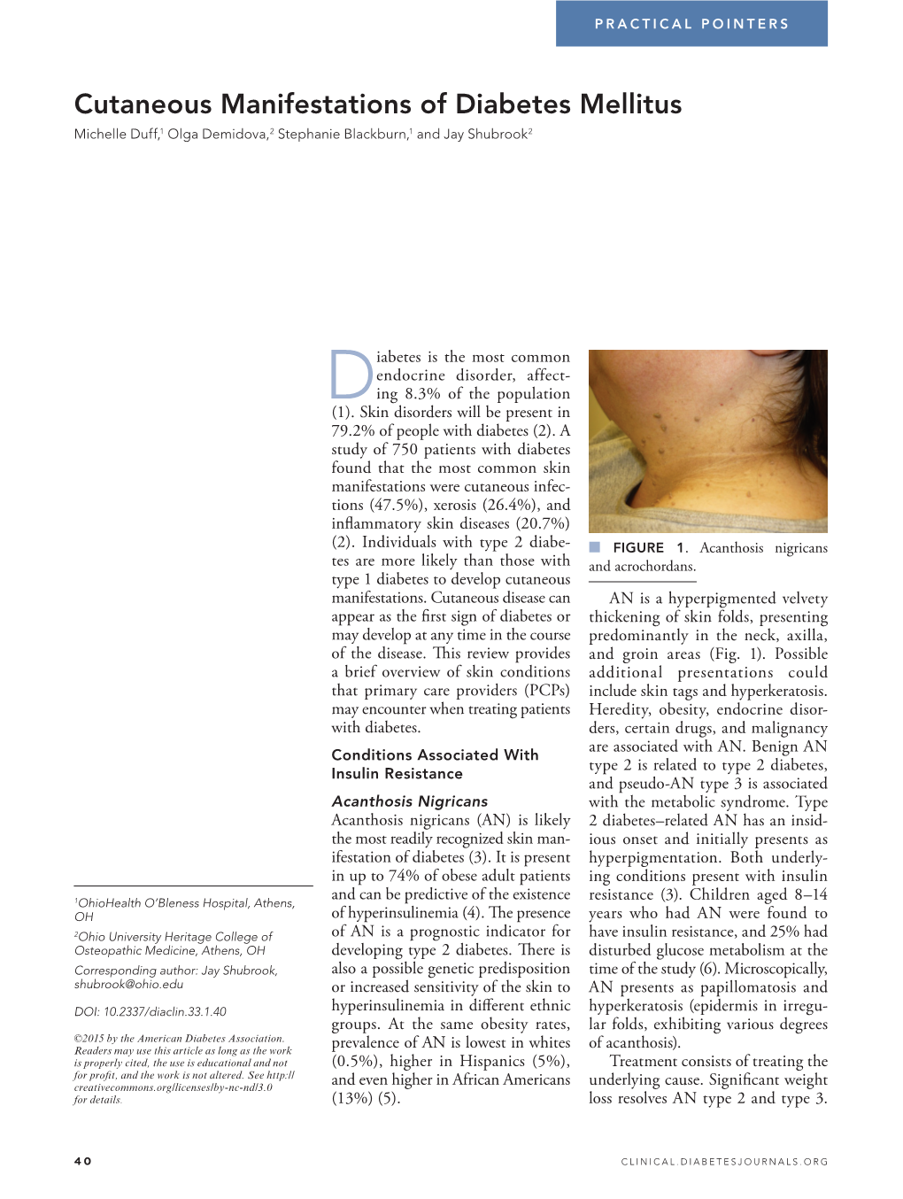 Cutaneous Manifestations of Diabetes Mellitus Michelle Duff,1 Olga Demidova,2 Stephanie Blackburn,1 and Jay Shubrook2