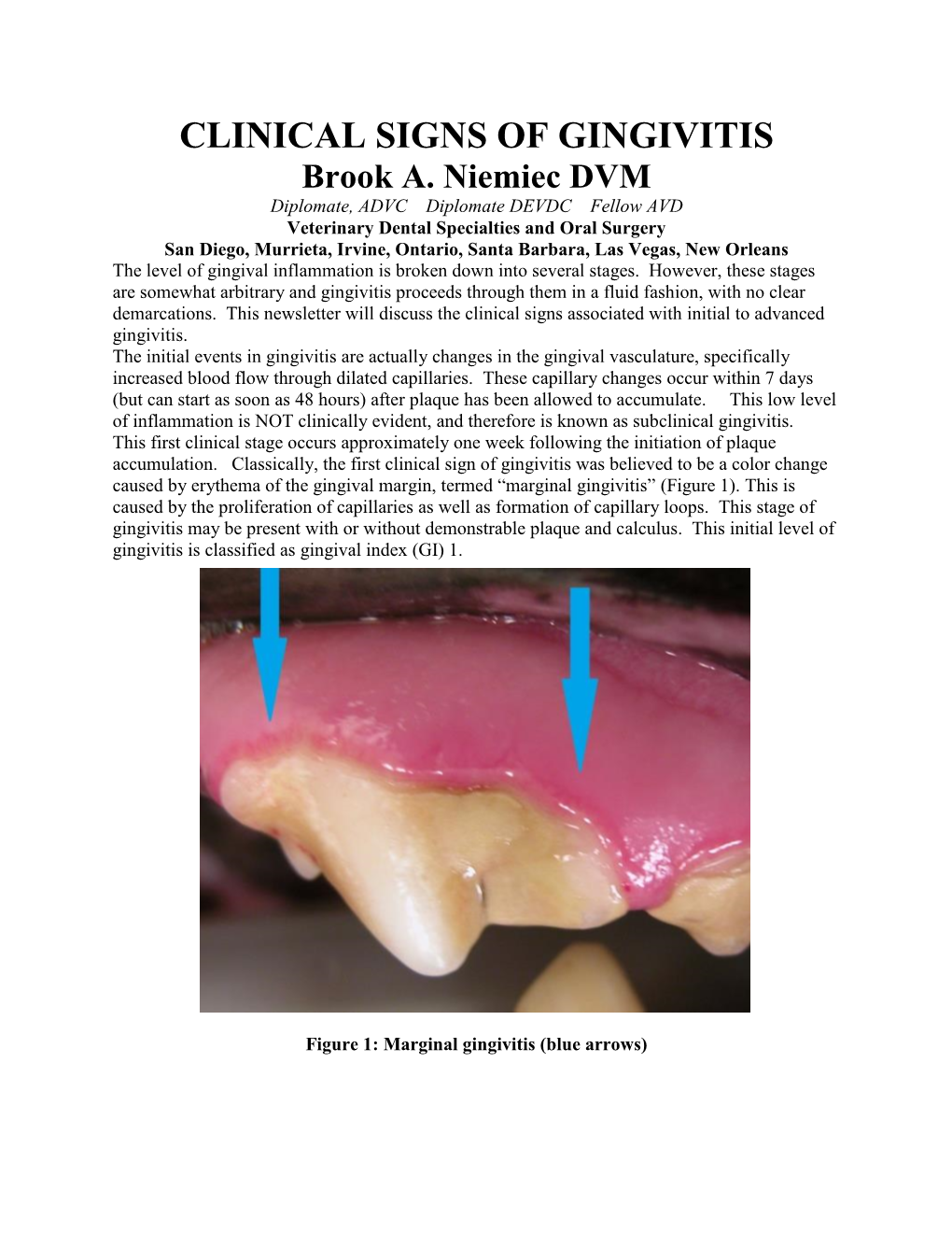 CLINICAL SIGNS of GINGIVITIS Brook A