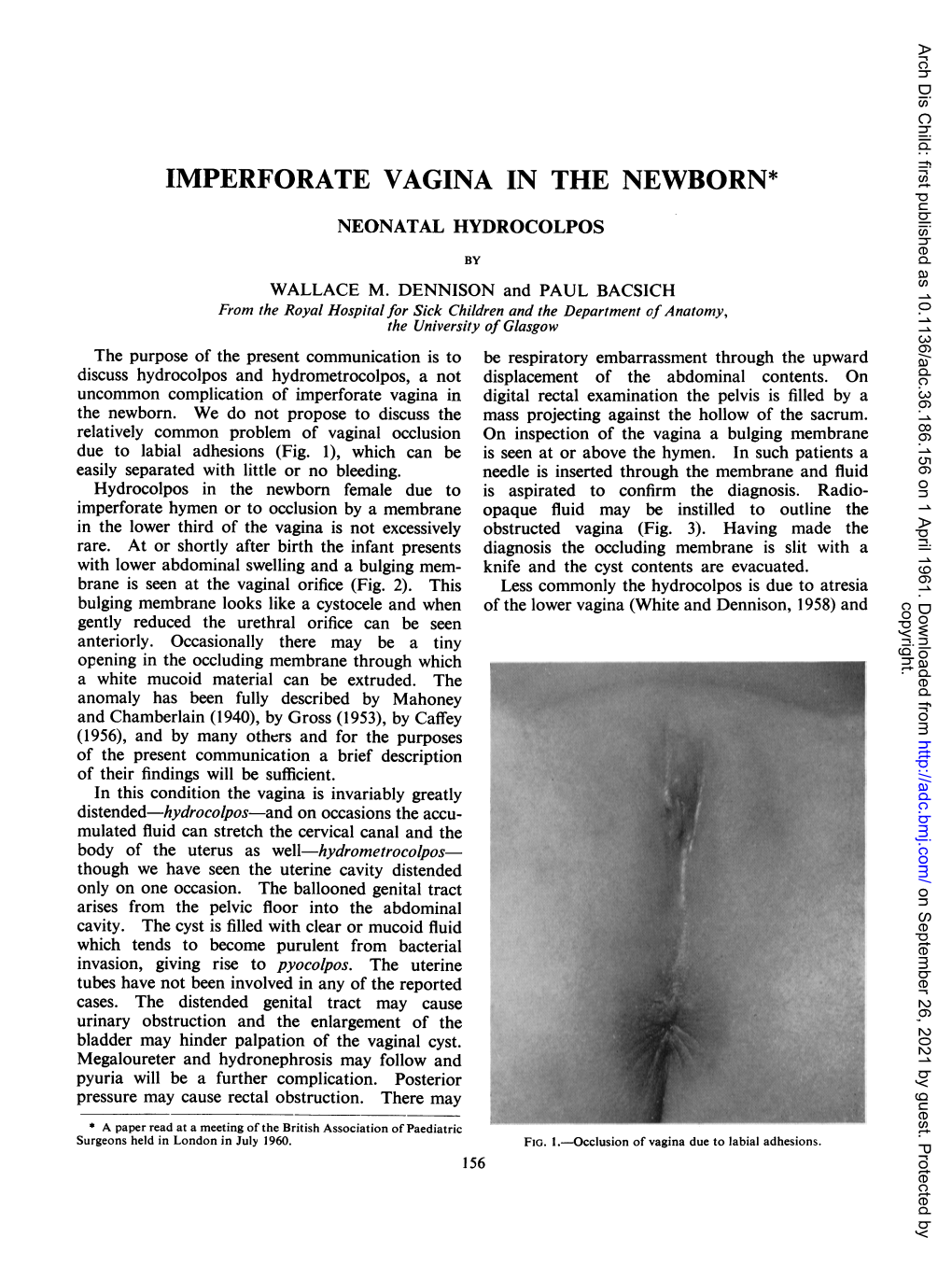 Imperforate Vaginain the Newborn*