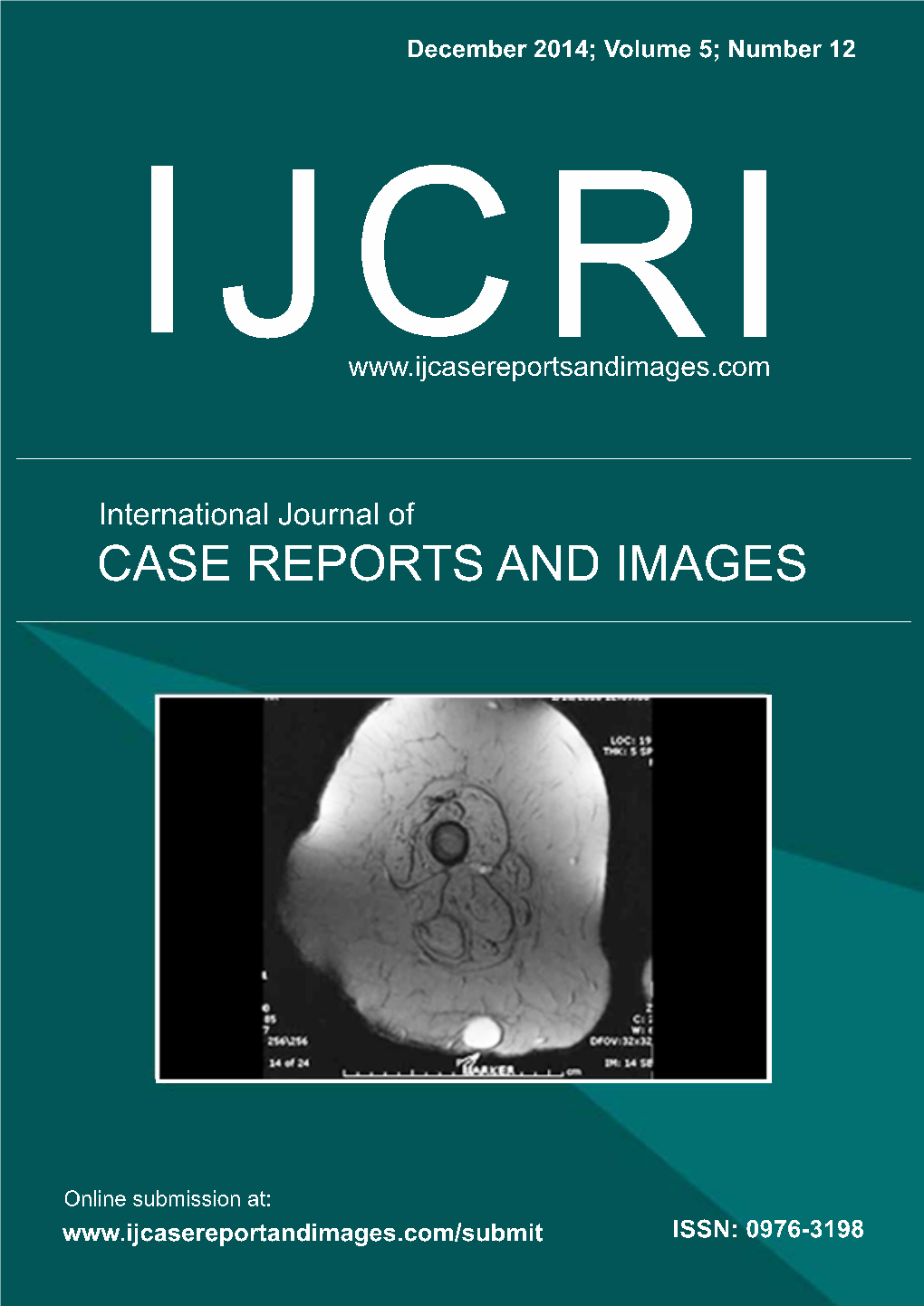 Ijcri 201412Ab Full Issue.Pdf