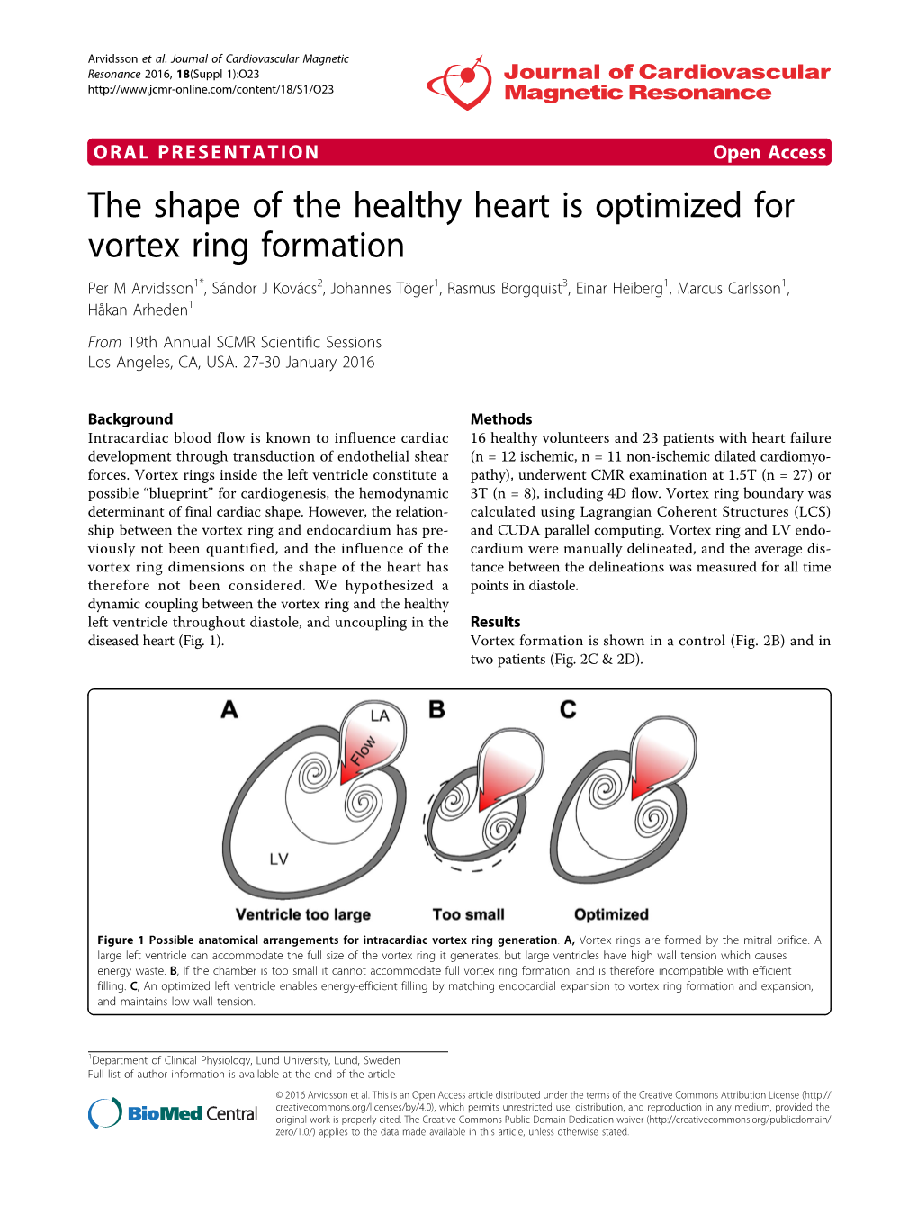 The Shape of the Healthy Heart Is Optimized for Vortex Ring Formation