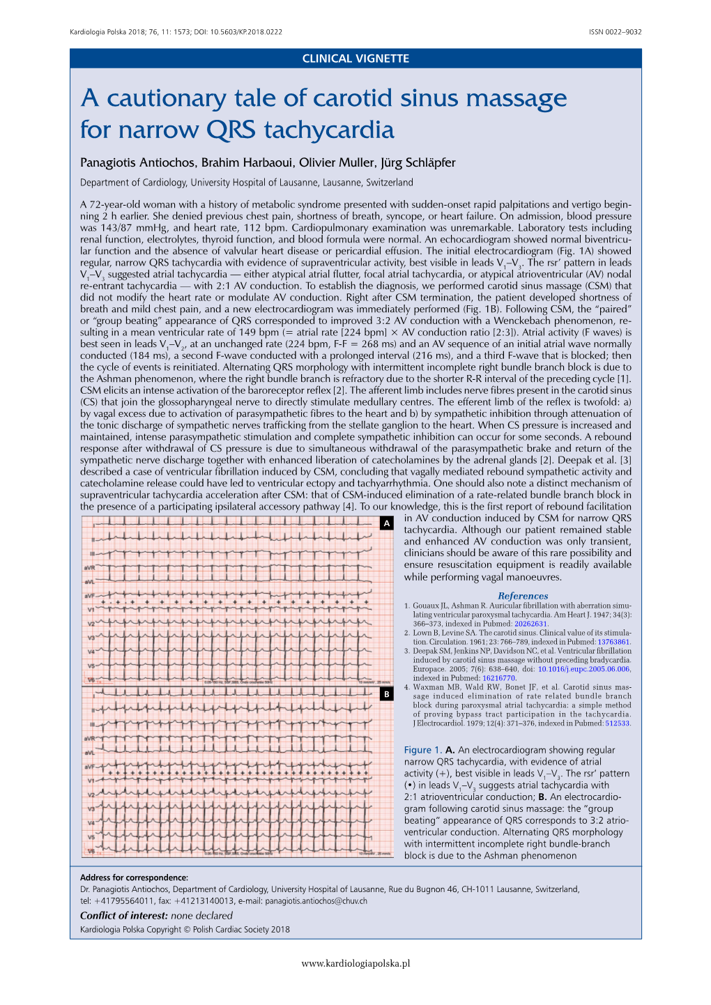 A Cautionary Tale of Carotid Sinus Massage for Narrow QRS Tachycardia