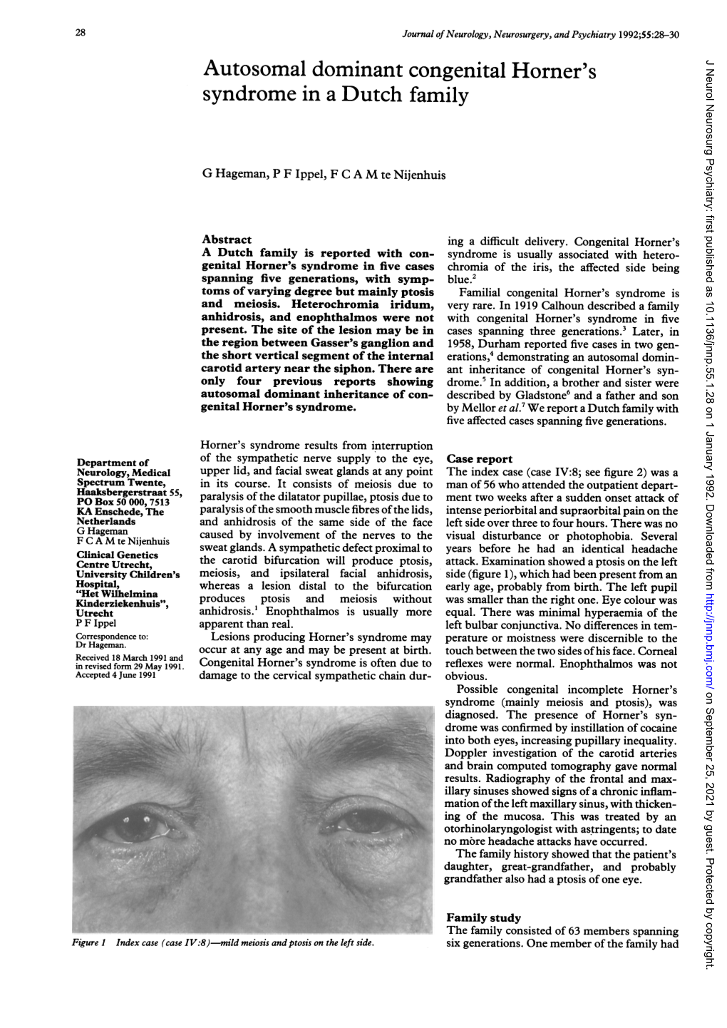 Autosomal Dominant Congenital Horner's J Neurol Neurosurg Psychiatry: First Published As 10.1136/Jnnp.55.1.28 on 1 January 1992
