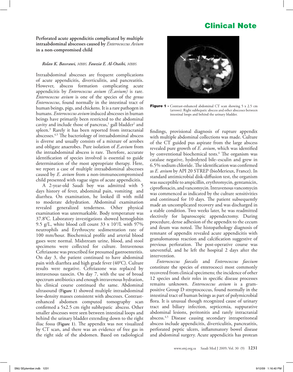 Perforated Acute Appendicitis Complicated by Multiple Intraabdominal Abscesses Caused by Enterococcus Avium in a Non-Compromised Child