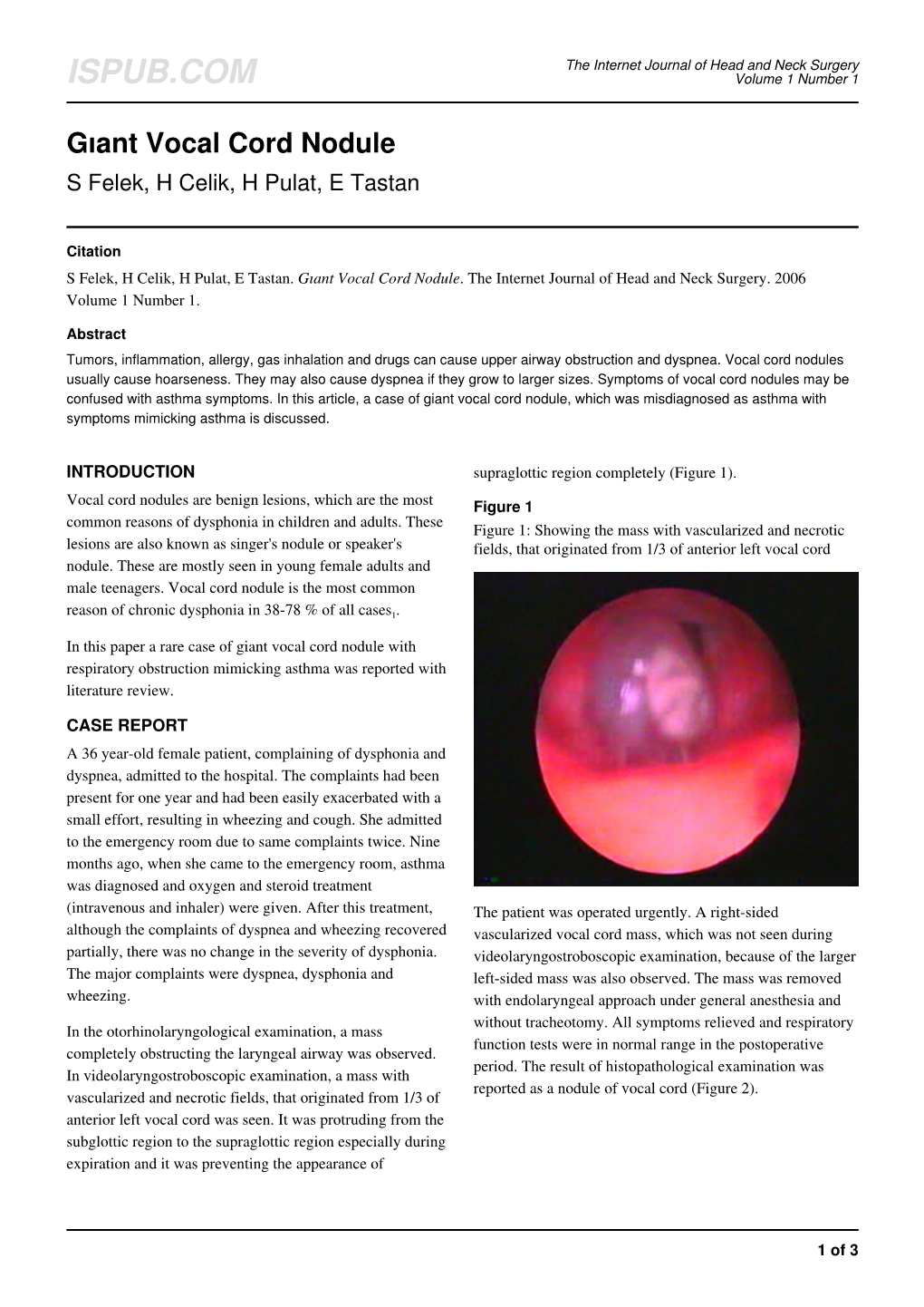 Gıant Vocal Cord Nodule S Felek, H Celik, H Pulat, E Tastan