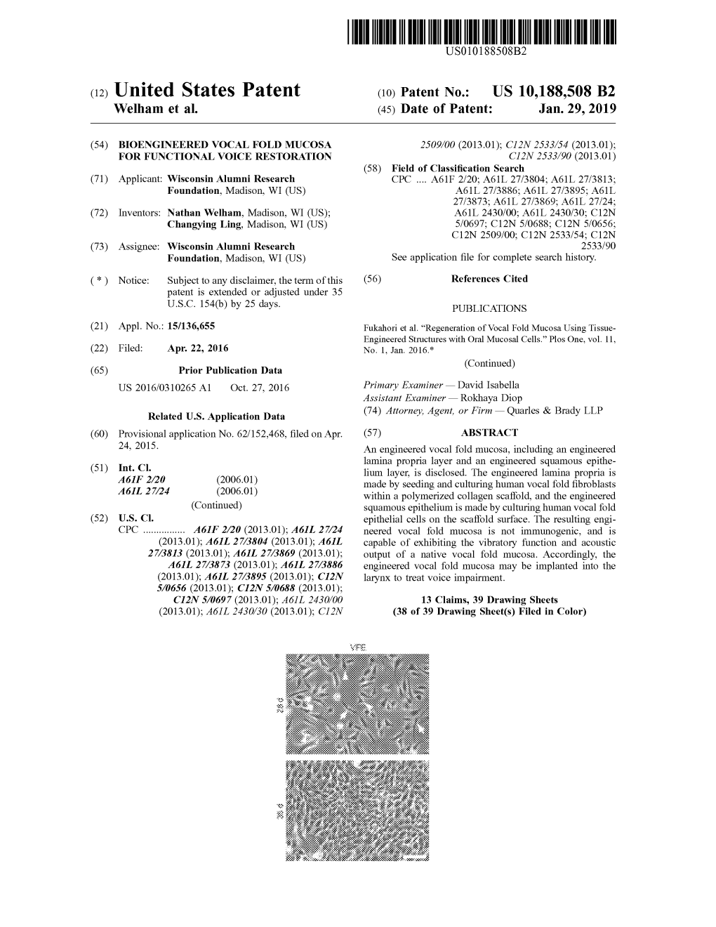 View U.S. Patent No. 10188508 in PDF Format