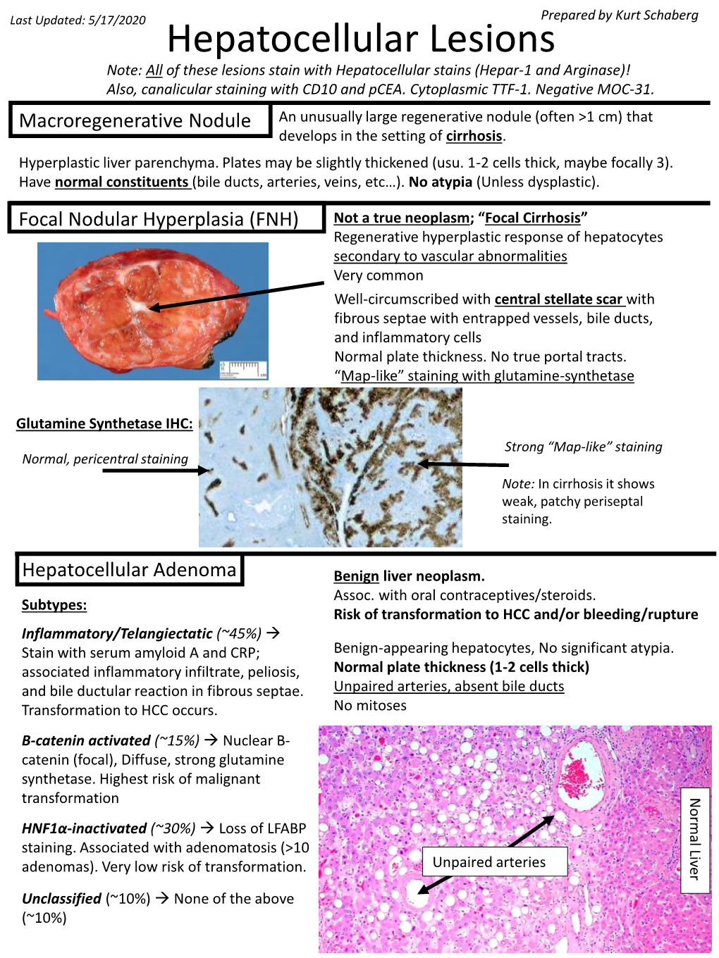 Hepatocellular Lesions Note: All of These Lesions Stain with Hepatocellular Stains (Hepar-1 and Arginase)! Also, Canalicular Staining with CD10 and Pcea