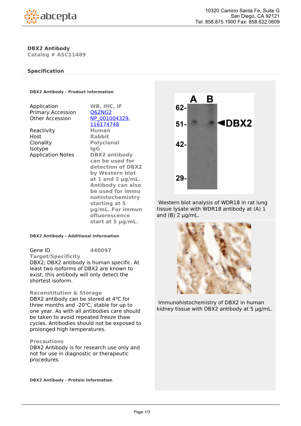 DBX2 Antibody Catalog # ASC11489