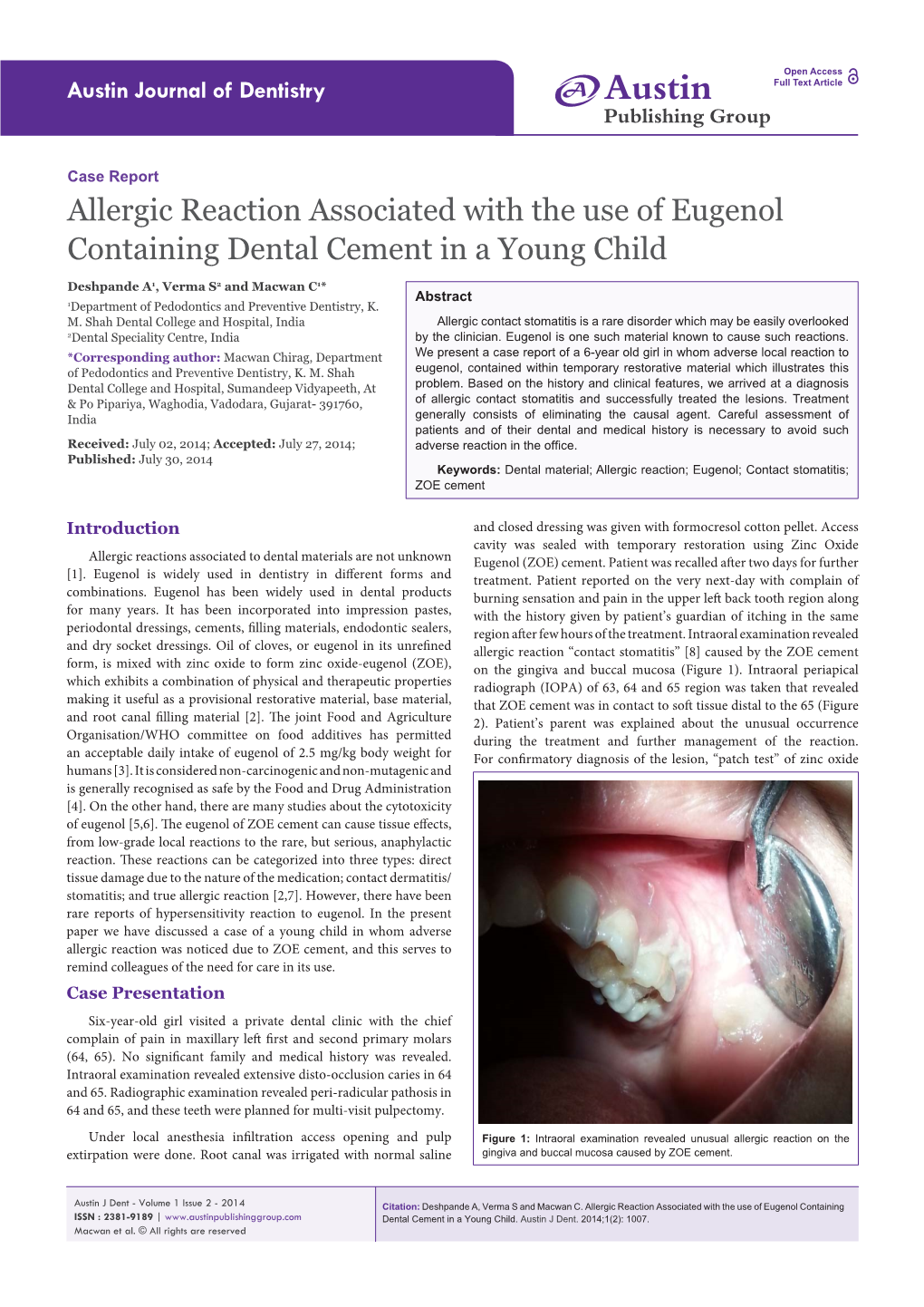 Allergic Reaction Associated with the Use of Eugenol Containing Dental Cement in a Young Child