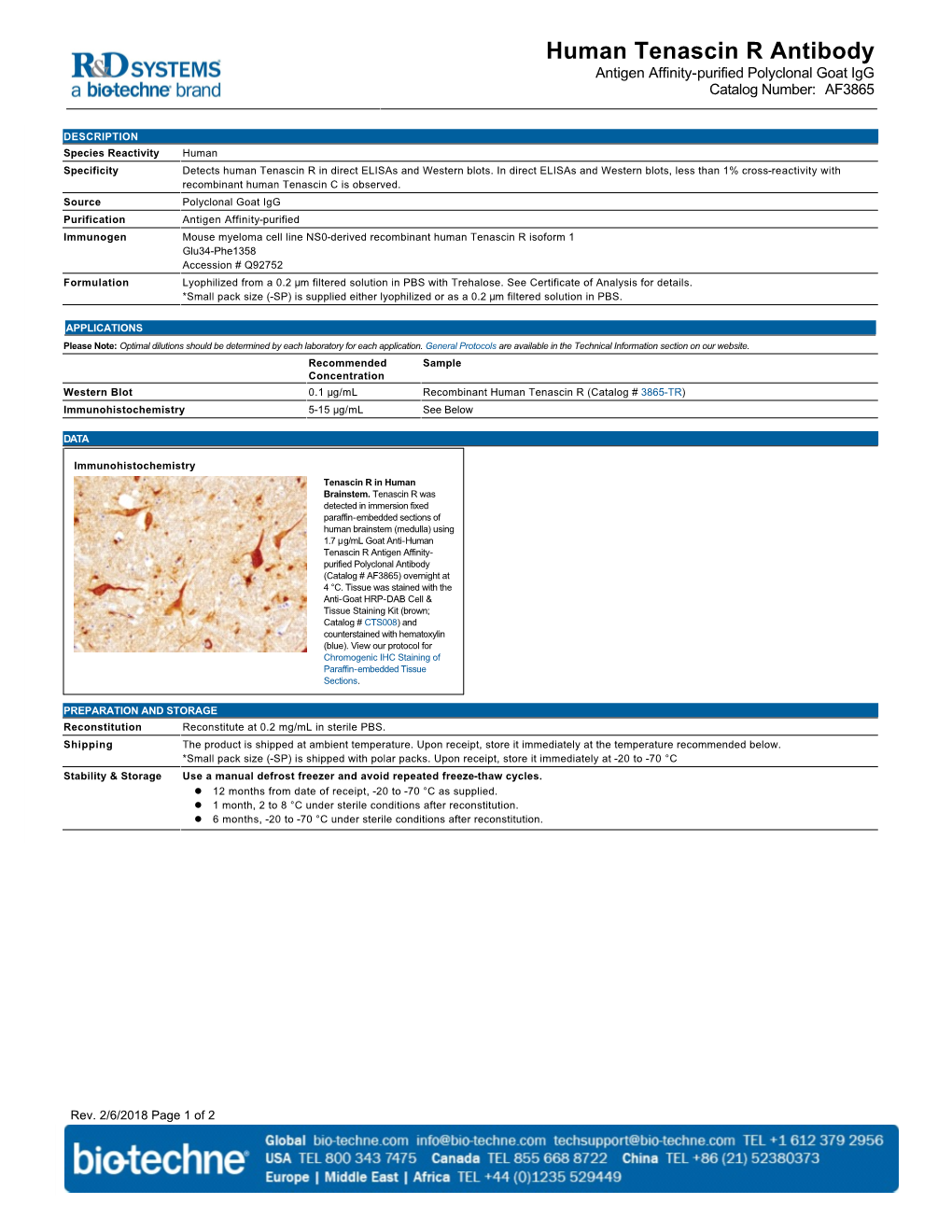 Human Tenascin R Antibody Antigen Affinity-Purified Polyclonal Goat Igg Catalog Number: AF3865