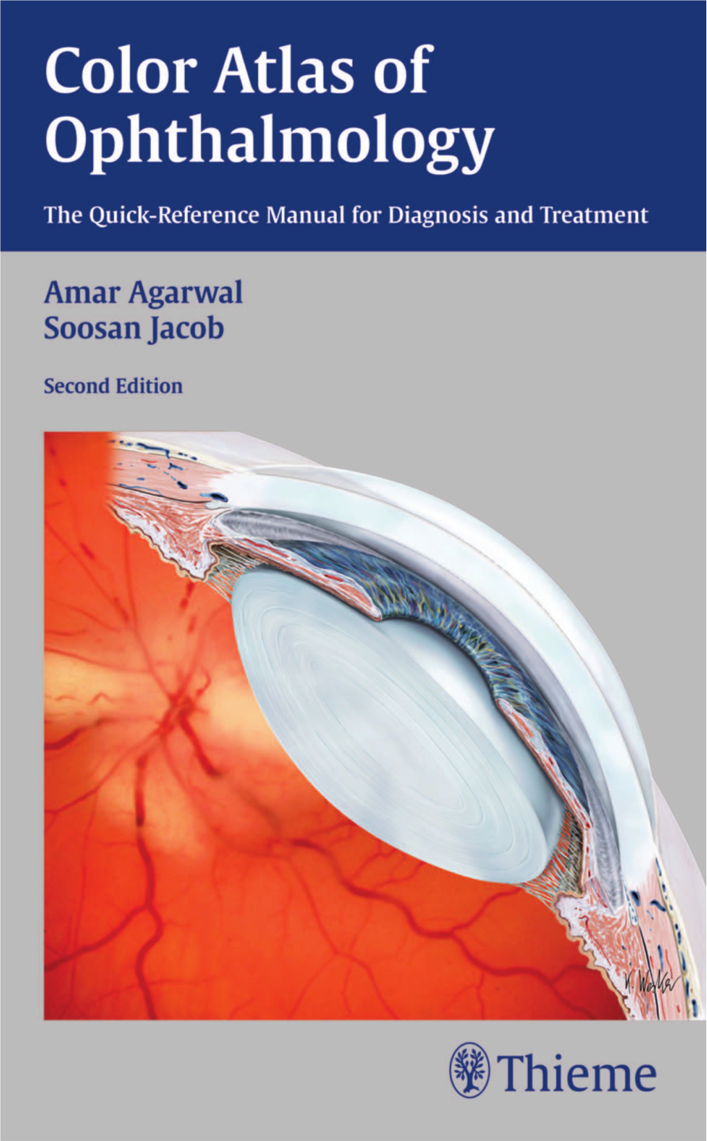 Color Atlas of Ophthalmology