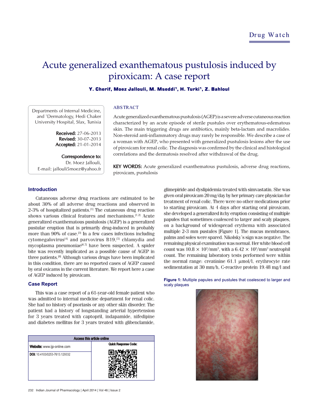 Acute Generalized Exanthematous Pustulosis Induced by Piroxicam: a Case Report