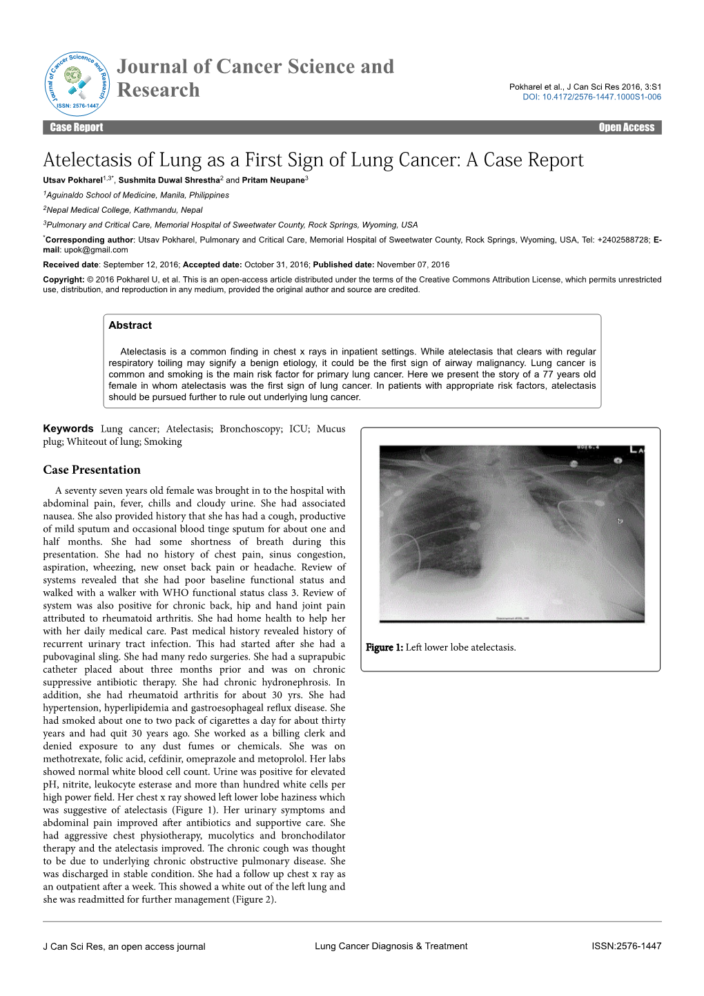 Atelectasis of Lung As a First Sign of Lung Cancer