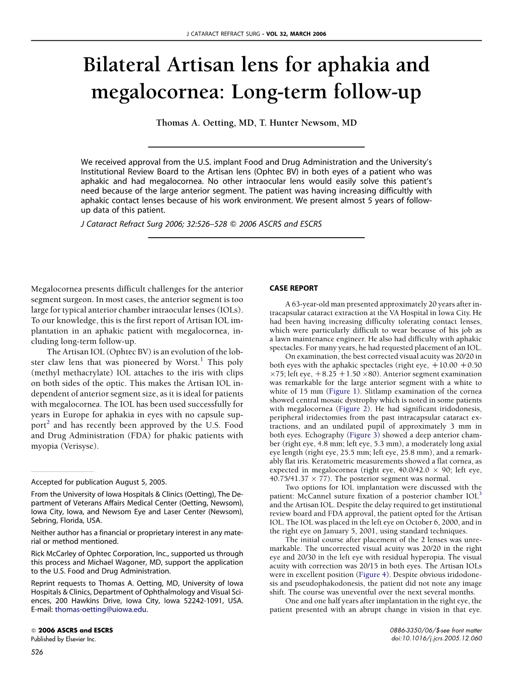 Bilateral Artisan Lens for Aphakia and Megalocornea: Long-Term Follow-Up