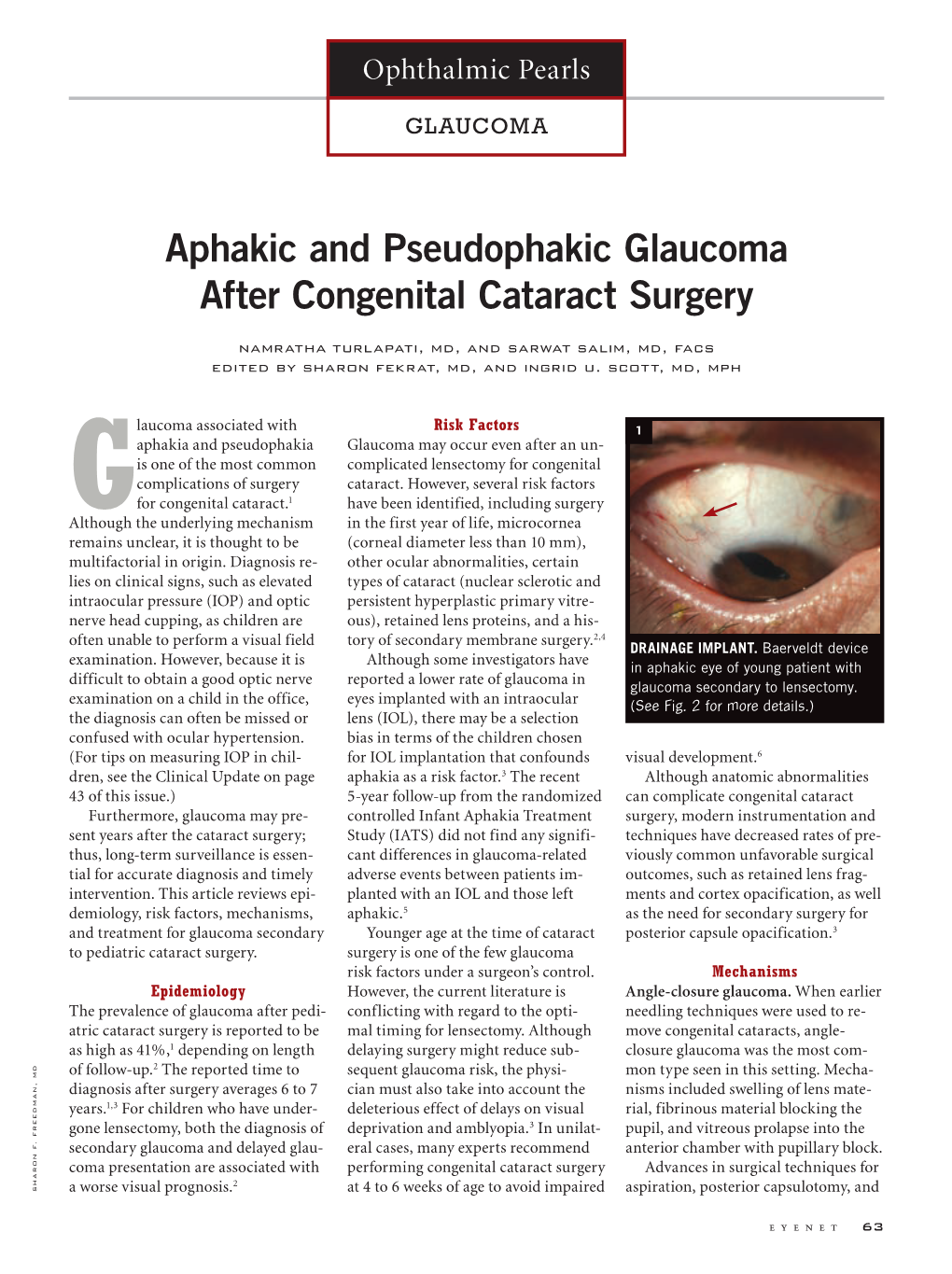 Aphakic and Pseudophakic Glaucoma After Congenital Cataract Surgery